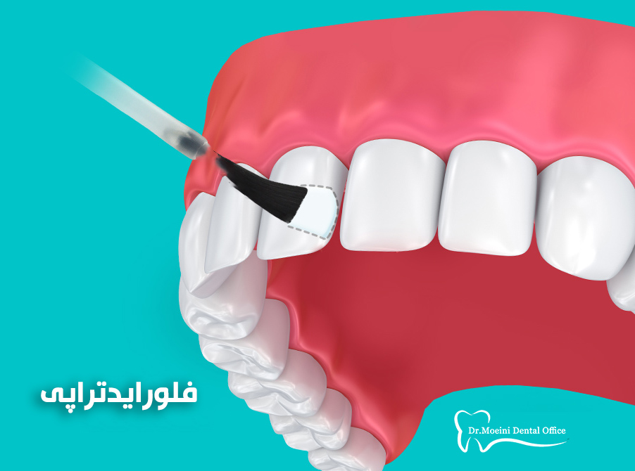 دندانپزشکی کودکان پیشگیری